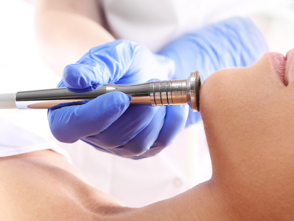 Microdermabrasion
