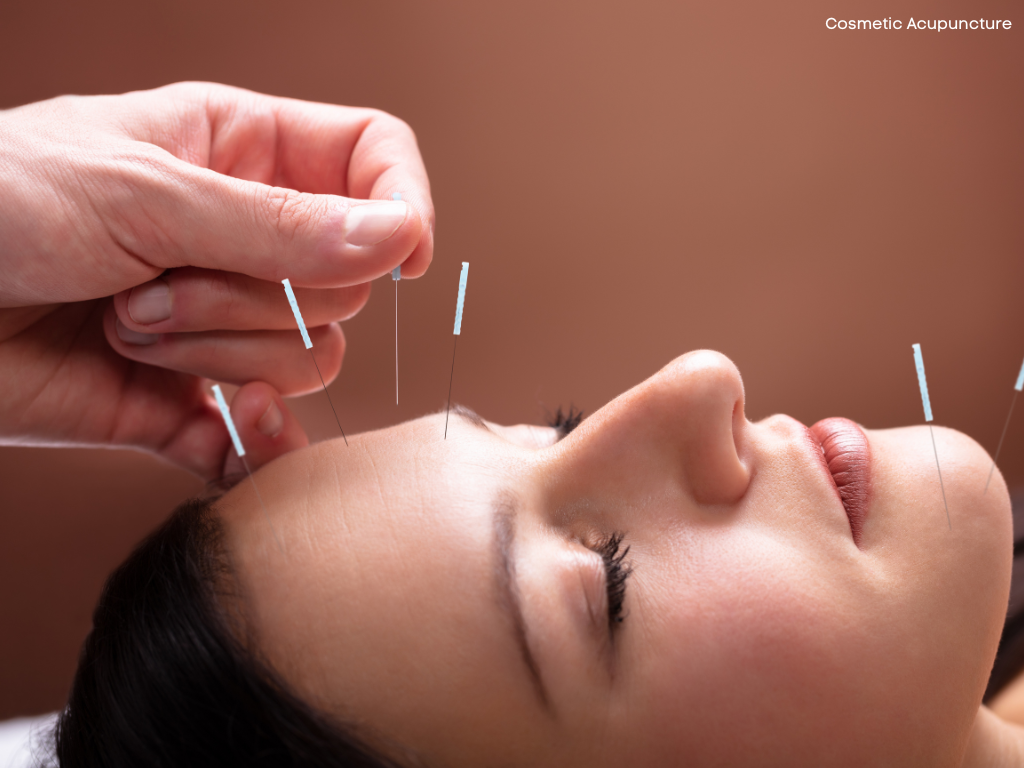 Cosmetic Acupuncture